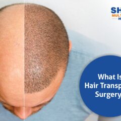 What İs Hair Transplantation